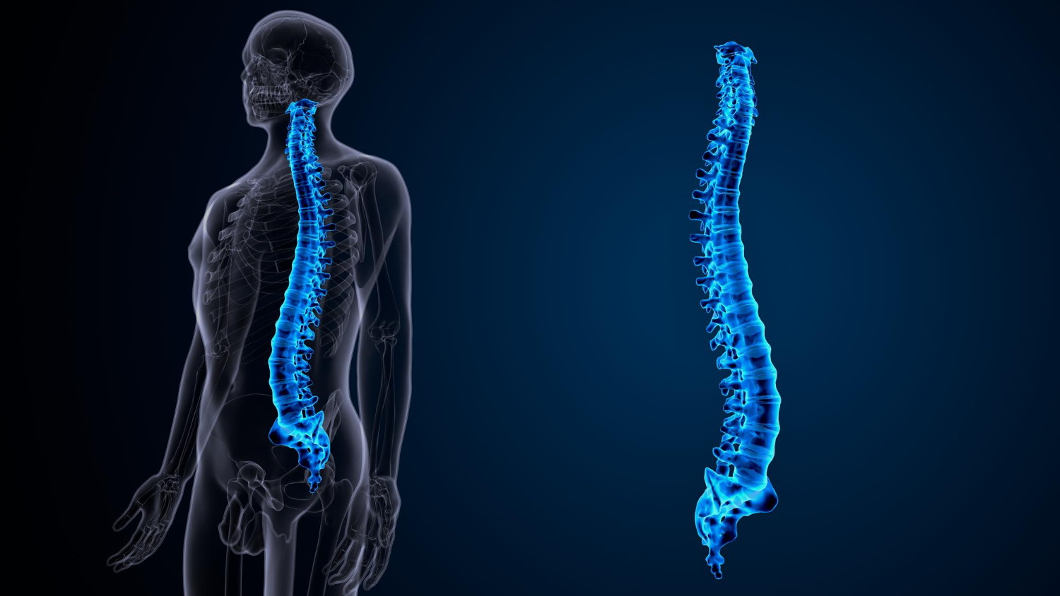 Imagem médica relacionada à coluna vertebral